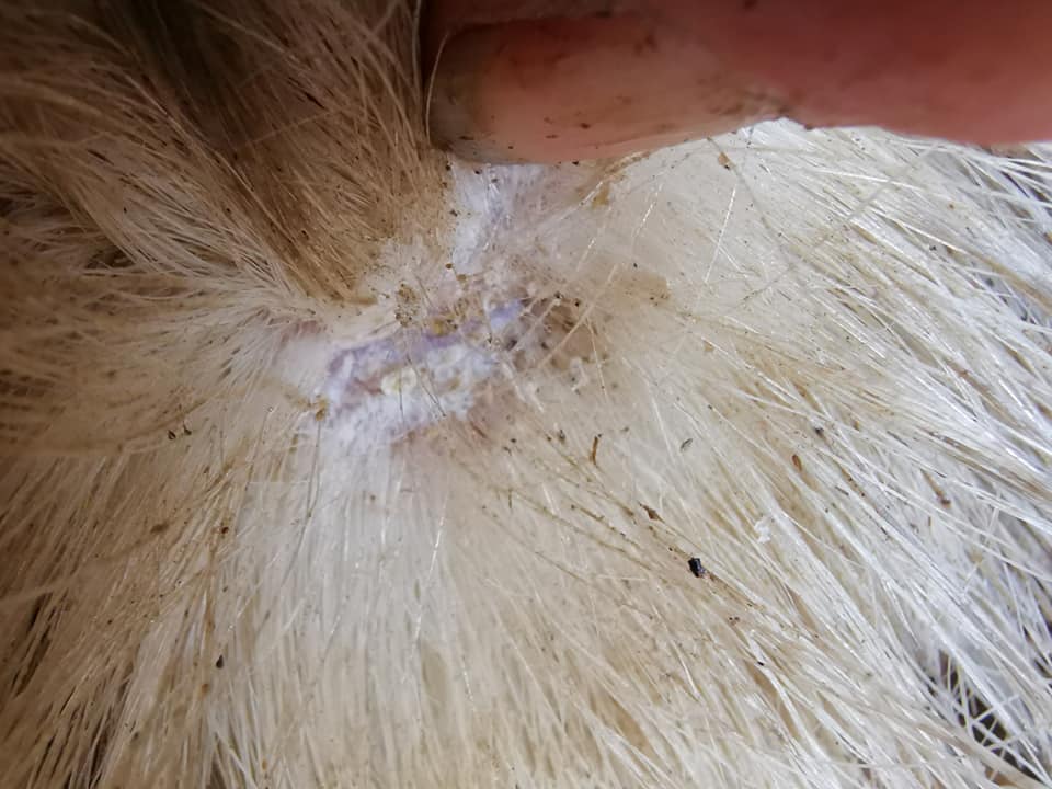 Chronic Progressive Lymphoedema – Information on Chronic Progressive ...